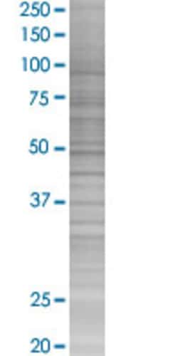 Abnova&trade;&nbsp;IFITM1 293T Cell Transient Overexpression Lysate (Denatured) (T04)