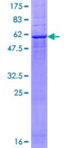 Abnova™ Human DEGS1 Full-length ORF (NP_003667.1, 1 a.a. - 323 a.a.) Recombinant Protein with GST-tag at N-terminal