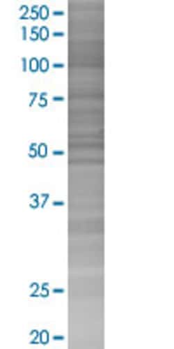 Abnova RGS20 293T Cell Transient Overexpression Lysate (Denatured) 100 &mu;L | Buy Online | Abnova&trade; | Fisher Scientific