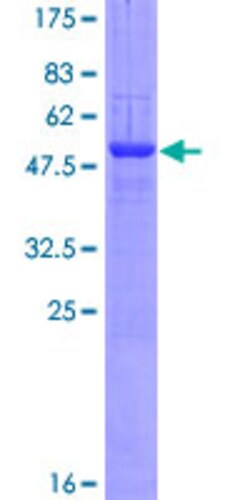 Abnova Human CADPS Full-length ORF (AAH15754.1, 1 a.a. - 222 a.a.) Recombinant Protein with GST-tag at N-terminal 10 &mu;g | Buy Online | Abnova&trade; | Fisher Scientific