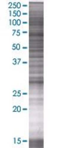 Abnova HSD17B6 293T Cell Transient Overexpression Lysate (Denatured) 100 &mu;L | Buy Online | Abnova&trade; | Fisher Scientific