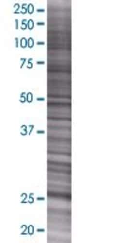Abnova&trade;&nbsp;SFRS9 293T Cell Transient Overexpression Lysate (Denatured)