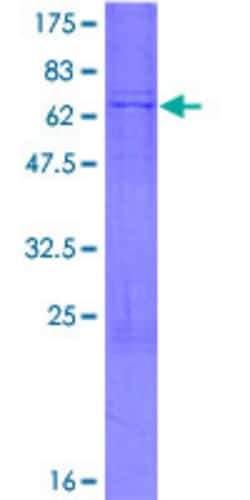 Abnova Human B4GALT3 Full-length ORF (NP_003770.1, 1 a.a. - 393 a.a.) Recombinant Protein with GST-tag at N-terminal 2 &mu;g | Buy Online | Abnova&trade; | Fisher Scientific