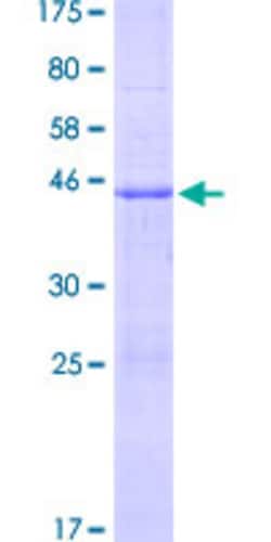 Abnova Human TNFSF12 Full-length ORF (AAH71837.1, 1 a.a. - 134 a.a.) Recombinant Protein with GST-tag at N-terminal 2 &mu;g | Buy Online | Abnova&trade; | Fisher Scientific
