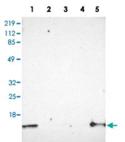 CSTA Rabbit anti-Human, Polyclonal , Abnova 100&mu;L; Unlabeled:Antibodies,