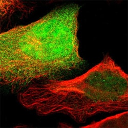 CSTA Rabbit anti-Human, Polyclonal , Abnova 100&mu;L; Unlabeled:Antibodies,