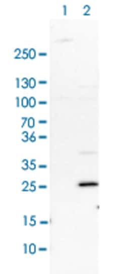 FHL1 Rabbit anti-Human, Rat, Polyclonal , Abnova 100 &mu;L | Buy Online | Abnova Corporation | Fisher Scientific