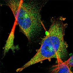 FHL1 Rabbit anti-Human, Rat, Polyclonal , Abnova 100 &mu;L | Buy Online | Abnova Corporation | Fisher Scientific