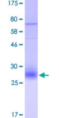 Abnova Purified TNFRSF10B (AAH01281.1, 56 a.a. - 210 a.a.) human Recombinant Protein with His-Flag-StrepII tag at N-terminus expressed in human cells 25 &mu;g | Buy Online | Abnova&trade; | Fisher Scientific