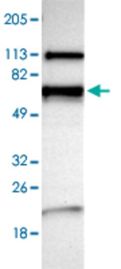 NMT2 Rabbit anti-Human, Polyclonal , Abnova 100&mu;L; Unlabeled:Antibodies,