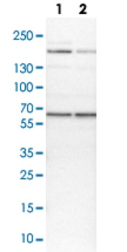 USP14 Rabbit anti-Human, Mouse, Rat, Polyclonal , Abnova 100&mu;L; Unlabeled:Antibodies,