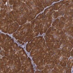 USP14 Rabbit anti-Human, Mouse, Rat, Polyclonal , Abnova 100&mu;L; Unlabeled:Antibodies,