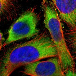 USP14 Rabbit anti-Human, Mouse, Rat, Polyclonal , Abnova 100&mu;L; Unlabeled:Antibodies,