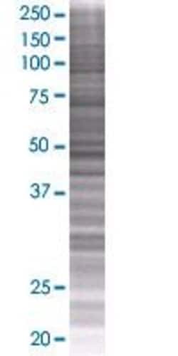 Abnova PROZ 293T Cell Transient Overexpression Lysate (Denatured) (T01) 100 &mu;L | Buy Online | Abnova&trade; | Fisher Scientific