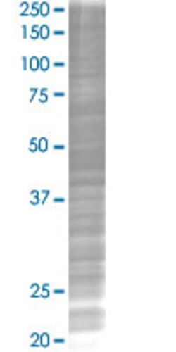Abnova C10orf7 293T Cell Transient Overexpression Lysate (Denatured) 100 &mu;l | Buy Online | Abnova&trade; | Fisher Scientific