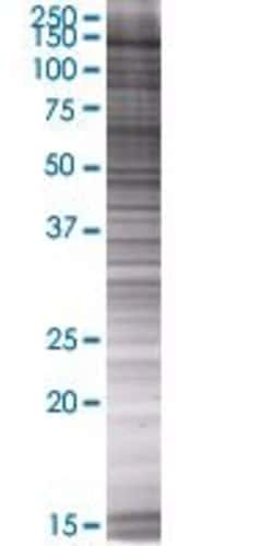 Abnova&trade;&nbsp;MTMR3 293T Cell Transient Overexpression Lysate (Denatured)