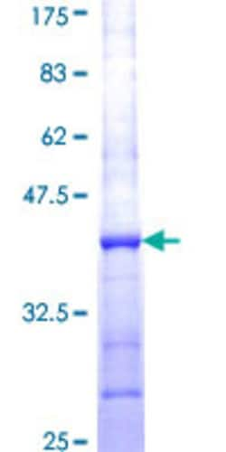 Abnova&trade;&nbsp;Human CPNE1 Partial ORF (NP_003906, 111 a.a. - 210 a.a.) Recombinant Protein with GST-tag at N-terminal 25&mu;g 