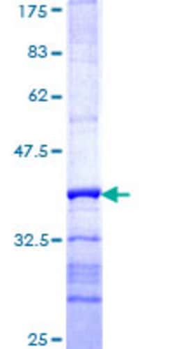 Abnova Human HERC3 Partial ORF (NP_055421, 1 a.a. - 109 a.a.) Recombinant Protein with GST-tag at N-terminal 25 &mu;g | Buy Online | Abnova&trade; | Fisher Scientific