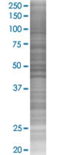 Abnova&trade;&nbsp;TRPA1 293T Cell Transient Overexpression Lysate (Denatured)