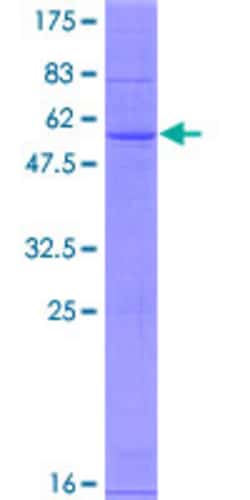 Abnova™ Human CH25H Full-length ORF (NP_003947.1, 1 a.a. - 272 a.a.) Recombinant Protein with GST-tag at N-terminal