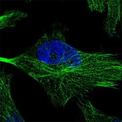 ZNF81 Rabbit anti-Human, Polyclonal , Abnova 100 &mu;L | Buy Online | Abnova | Fisher Scientific