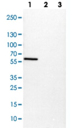 VIM Rabbit anti-Human, Mouse, Polyclonal , Abnova 100&mu;L; Unlabeled:Antibodies,