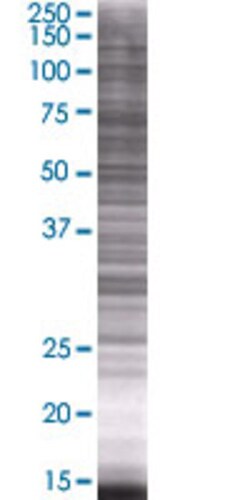 Abnova ARTN 293T Cell Transient Overexpression Lysate (Denatured) 100 &mu;L | Buy Online | Abnova&trade; | Fisher Scientific