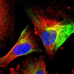 VIM Rabbit anti-Human, Mouse, Polyclonal , Abnova 100&mu;L; Unlabeled:Antibodies,