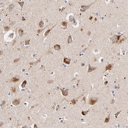 SSBP1 Rabbit anti-Human, Mouse, Rat, Polyclonal , Abnova 100 &mu;L | Buy Online | Abnova Corporation | Fisher Scientific