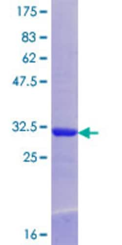 Abnova&trade;&nbsp;Human SDCCAG1 Partial ORF (NP_004704.2, 1010 a.a. - 1076 a.a.) Recombinant Protein with GST-tag at N-terminal 10&mu;g 