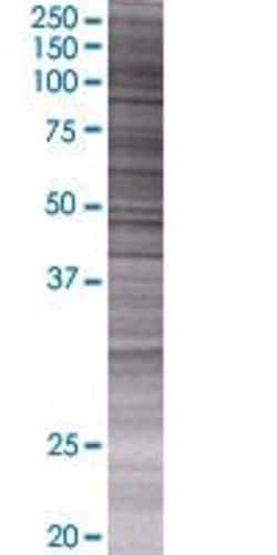 Abnova EXO1 293T Cell Transient Overexpression Lysate (Denatured) 100 &mu;L | Buy Online | Abnova&trade; | Fisher Scientific