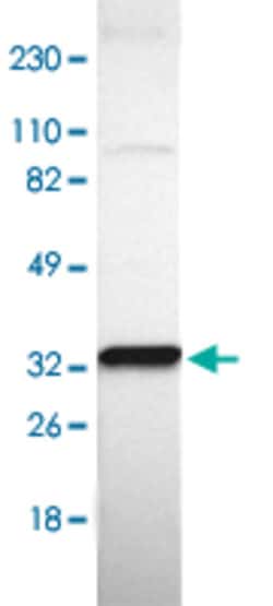 TXNDC1 Rabbit anti-Human, Polyclonal , Abnova 100 &mu;L | Buy Online | Abnova Corporation | Fisher Scientific