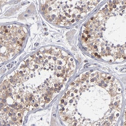 TXNDC1 Rabbit anti-Human, Polyclonal , Abnova 100 &mu;L | Buy Online | Abnova Corporation | Fisher Scientific