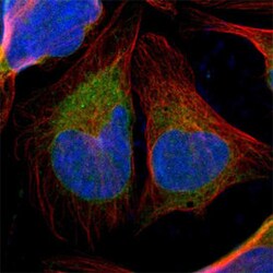 TXNDC1 Rabbit anti-Human, Polyclonal , Abnova 100 &mu;L | Buy Online | Abnova Corporation | Fisher Scientific