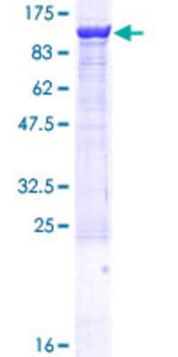 Abnova Human ZW10 Full-length ORF (NP_004715.1, 1 a.a. - 779 a.a.) Recombinant