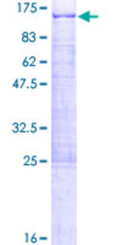 Abnova Human DDX21 Full-length ORF (NP_004719.2, 1 a.a. - 783 a.a.) Recombinant Protein with GST-tag at N-terminal 2 &mu;g | Buy Online | Abnova&trade; | Fisher Scientific