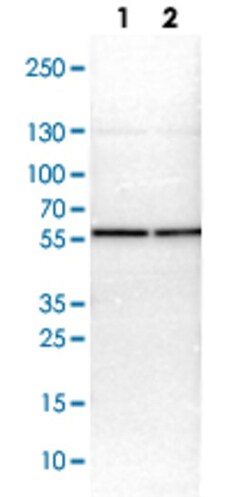 CCT2 Rabbit anti-Human, Mouse, Rat, Polyclonal Antibody, Abnova 100&mu;L;