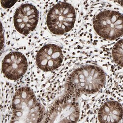 RPS6KA3 Rabbit anti-Human, Mouse, Rat, Polyclonal , Abnova 100 &mu;L | Buy Online | Abnova Corporation | Fisher Scientific