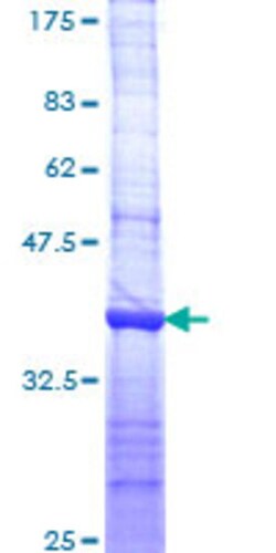 Abnova Human DLG5 Partial ORF (NP_004738, 1708 a.a. - 1809 a.a.) Recombinant