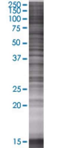 Abnova PNMA1 293T Cell Transient Overexpression Lysate (Denatured) (T01) 100 &mu;L | Buy Online | Abnova&trade; | Fisher Scientific