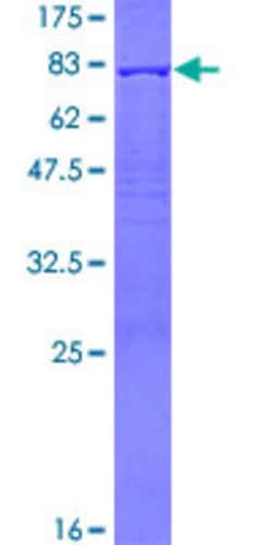 Abnova Human PDLIM7 Full-length ORF (AAH01093.1, 1 a.a. - 457 a.a.) Recombinant Protein with GST-tag at N-terminal 25 &mu;g | Buy Online | Abnova&trade; | Fisher Scientific