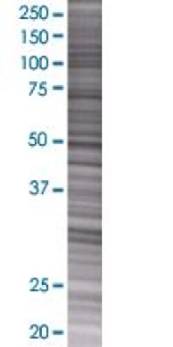 Abnova SLC9A3R1 293T Cell Transient Overexpression Lysate (Denatured) 100 &mu;L | Buy Online | Abnova&trade; | Fisher Scientific