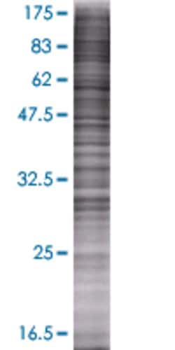 Abnova&trade;&nbsp;PPT2 293T Cell Transient Overexpression Lysate (Denatured)