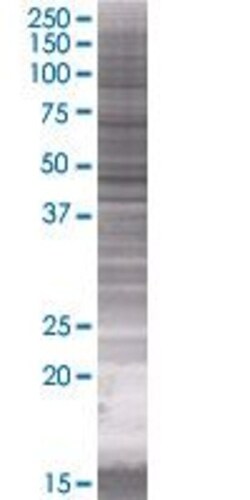 Abnova SLC22A8 293T Cell Transient Overexpression Lysate (Denatured) (T01) 100 &mu;L | Buy Online | Abnova&trade; | Fisher Scientific