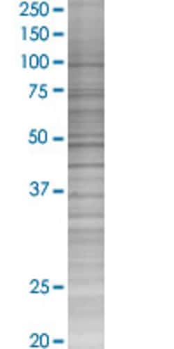 Abnova TMPRSS11D 293T Cell Transient Overexpression Lysate (Denatured) (T02) 100 &mu;L | Buy Online | Abnova&trade; | Fisher Scientific