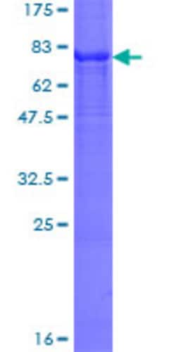 Abnova Human CYP7B1 Full-length ORF (NP_004811.1, 1 a.a. - 506 a.a.) Recombinant