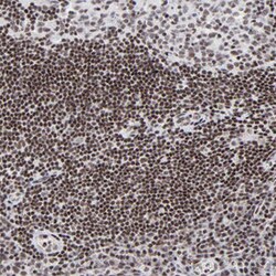 SP2 Rabbit anti-Human, Polyclonal , Abnova 100&mu;L; Unlabeled:Antibodies,