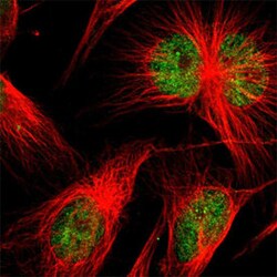SP2 Rabbit anti-Human, Polyclonal , Abnova 100&mu;L; Unlabeled:Antibodies,