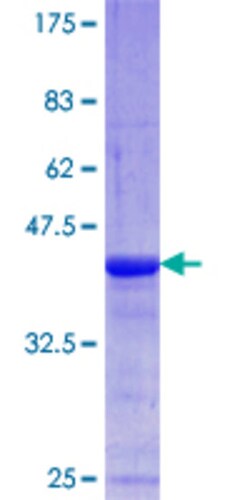 Abnova Human AKAP6 Partial ORF (NP_004265.3, 2221 a.a. - 2318 a.a.) Recombinant