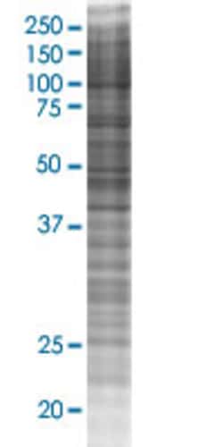 Abnova STX8 293T Cell Transient Overexpression Lysate (Denatured) (T02) 100 &mu;L | Buy Online | Abnova&trade; | Fisher Scientific